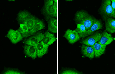 Anti-RPS26 antibody used in Immunocytochemistry/ Immunofluorescence (ICC/IF). GTX131193