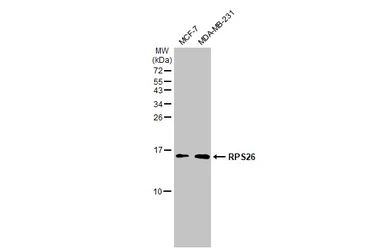 Anti-RPS26 antibody used in Western Blot (WB). GTX131193
