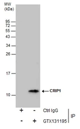 Anti-CRIP1 antibody used in Immunoprecipitation (IP). GTX131195