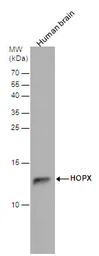 Anti-HOPX antibody used in Western Blot (WB). GTX131224
