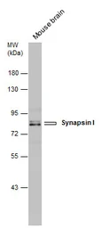 Anti-Synapsin I antibody used in Western Blot (WB). GTX131233