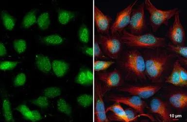 Anti-ARID5B antibody used in Immunocytochemistry/ Immunofluorescence (ICC/IF). GTX131249