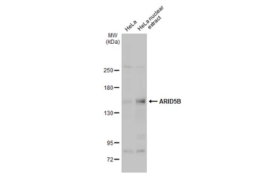 Anti-ARID5B antibody used in Western Blot (WB). GTX131249