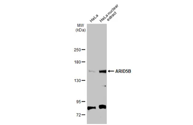 Anti-ARID5B antibody used in Western Blot (WB). GTX131249