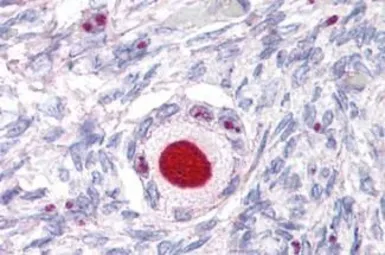 Anti-Steroidogenic Factor 1 antibody used in IHC (Paraffin sections) (IHC-P). GTX13132