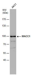 Anti-MACC1 antibody used in Western Blot (WB). GTX131332