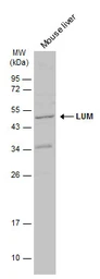 Anti-LUM antibody used in Western Blot (WB). GTX131377