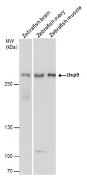 Anti-Usp9 antibody used in Western Blot (WB). GTX131402
