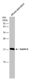 Anti-Leptin b antibody used in Western Blot (WB). GTX131406