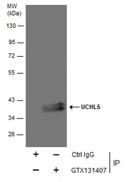 Anti-UCHL5 antibody used in Immunoprecipitation (IP). GTX131407