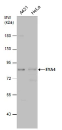 Anti-EYA4 antibody used in Western Blot (WB). GTX131408