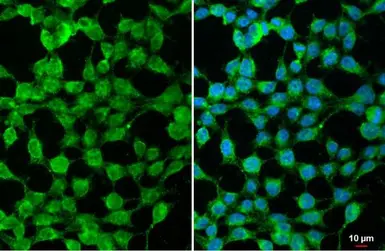 Anti-SARM1 antibody used in Immunocytochemistry/ Immunofluorescence (ICC/IF). GTX131411