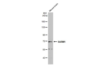 Anti-SARM1 antibody used in Western Blot (WB). GTX131411