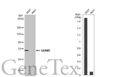 Anti-SARM1 antibody used in Western Blot (WB). GTX131411