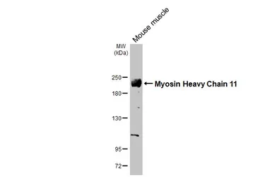 Anti-Myosin Heavy Chain 11 antibody used in Western Blot (WB). GTX131414