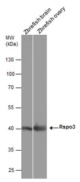Anti-Rspo3 antibody used in Western Blot (WB). GTX131425