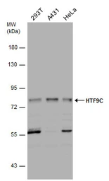 Anti-HTF9C antibody used in Western Blot (WB). GTX131442