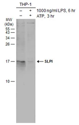 Anti-SLPI antibody used in Western Blot (WB). GTX131447