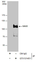 Anti-VAV2 antibody used in Immunoprecipitation (IP). GTX131451