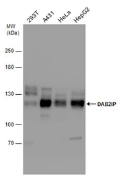 Anti-DAB2IP antibody used in Western Blot (WB). GTX131468