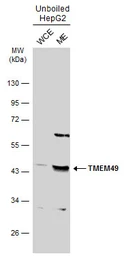 Anti-TMEM49 antibody used in Western Blot (WB). GTX131510
