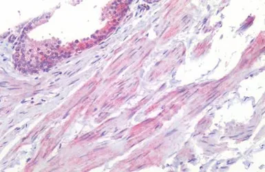Anti-5-HT1B receptor antibody used in IHC (Paraffin sections) (IHC-P). GTX13154