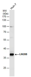 Anti-LIN28B antibody used in Western Blot (WB). GTX131546