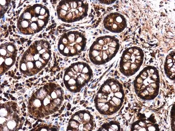 Anti-LIN28B antibody used in IHC (Paraffin sections) (IHC-P). GTX131546