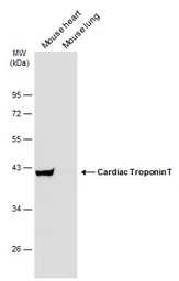 Anti-Cardiac Troponin T antibody used in Western Blot (WB). GTX131562