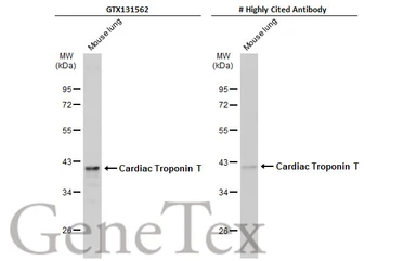 Anti-Cardiac Troponin T antibody used in Western Blot (WB). GTX131562
