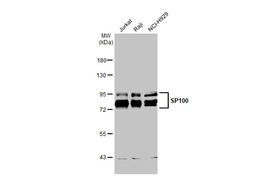 Anti-SP100 antibody used in Western Blot (WB). GTX131569