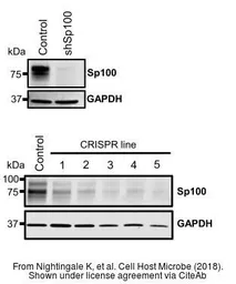 Anti-SP100 antibody used in Western Blot (WB). GTX131570