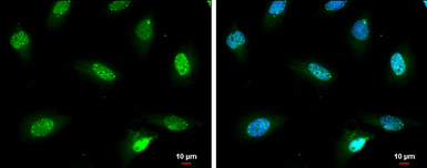 Anti-SP100 antibody used in Immunocytochemistry/ Immunofluorescence (ICC/IF). GTX131570