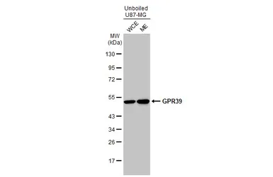 Anti-GPR39 antibody used in Western Blot (WB). GTX131599