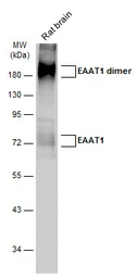 Anti-EAAT1 antibody used in Western Blot (WB). GTX131623