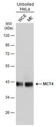 Anti-MCT4 antibody used in Western Blot (WB). GTX131626