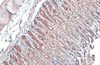 Anti-GALNT3 antibody used in IHC (Paraffin sections) (IHC-P). GTX131628