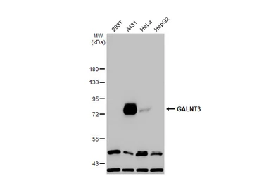 Anti-GALNT3 antibody used in Western Blot (WB). GTX131628