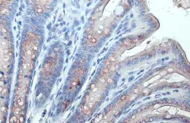 Anti-GALNT3 antibody used in IHC (Paraffin sections) (IHC-P). GTX131628
