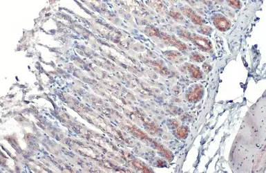 Anti-GALNT3 antibody used in IHC (Paraffin sections) (IHC-P). GTX131628