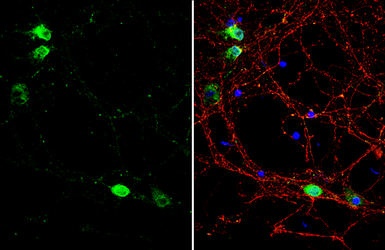 Anti-VAPB antibody used in Immunocytochemistry/ Immunofluorescence (ICC/IF). GTX131631
