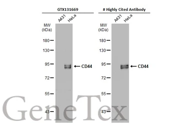 Anti-CD44 antibody used in Western Blot (WB). GTX131669