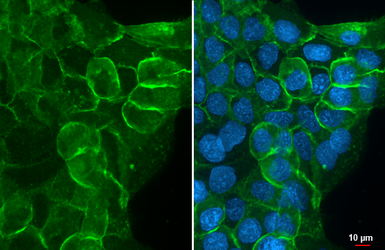 Anti-CD44 antibody used in Immunocytochemistry/ Immunofluorescence (ICC/IF). GTX131669