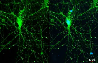 Anti-SYNGAP1 antibody used in Immunocytochemistry/ Immunofluorescence (ICC/IF). GTX131673