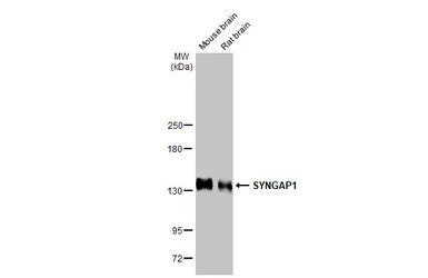 Anti-SYNGAP1 antibody used in Western Blot (WB). GTX131673