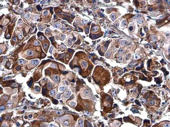 Anti-BASP1 antibody used in IHC (Paraffin sections) (IHC-P). GTX131728