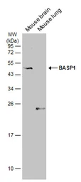Anti-BASP1 antibody used in Western Blot (WB). GTX131728