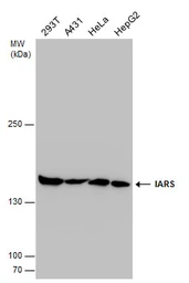 Anti-IARS antibody used in Western Blot (WB). GTX131733