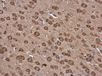 Anti-IARS antibody used in IHC (Paraffin sections) (IHC-P). GTX131733