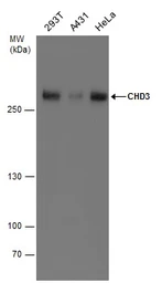 Anti-CHD3 antibody used in Western Blot (WB). GTX131779